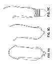 Fig. 08 - ADJUSTABLE PROSTHETIC SOCKET AND SUSPENSION SYSTEM