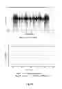 Fig. 09 - Method and system for detection of onset of near-end signal in an echo cancellation system