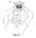 Fig. 05 - Message-Conveying Interlocking Athletic Gloves
