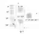 Fig. 02 - Multi-layer non - woven fabric multi-use material for ballistic and stab resistance comprising impregnated and oriented fiber non - woven fabric layers; manufacturing, method, and protection garment produced thereby