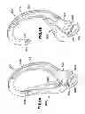 Fig. 02 - Snap hook