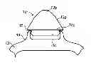 Fig. 01 - SETTING FOR GEMSTONES, PARTICULARLY DIAMONDS