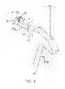 Fig. 04 - NAIL POSITIONING DEVICE
