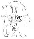Fig. 02 - Pistol cocking assistive device