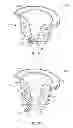 Fig. 22 - Liquid flow control and beverage preparation apparatuses