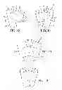 Fig. 06 - Device for stabilizing an inflatable structure