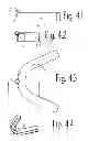 Fig. 03 - Oral device for improvement of breathing
