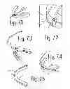 Fig. 05 - Oral device for improvement of breathing