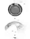 Fig. 02 - Methods and apparatus to form electronic circuitry on ophthalmic devices