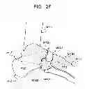 Fig. 09 - Medical image processing apparatus