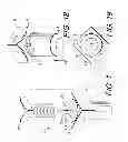 Fig. 02 - Encapsulated fastener and method and tooling for manufacturing same