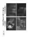 Fig. 09 - USE OF ADENOSINE RECEPTOR SIGNALING TO MODULATE PERMEABILITY OF BLOOD-BRAIN BARRIER