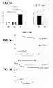Fig. 02 - METHOD FOR THE PROGNOSIS OF THE PROGRESSION OF CANCER
