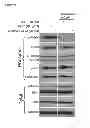 Fig. 41 - Methods and compositions using Kloto-FGF23 fusion polypeptides