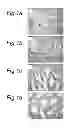 Fig. 02 - Immunotherapeutic method for treating prostate cancer