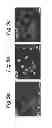 Fig. 06 - Immunotherapeutic method for treating prostate cancer