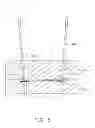 Fig. 06 - Injection mold having exhaust grooves