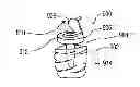 Fig. 01 - Baby Bottle Preparation