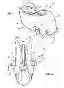 Fig. 02 - Bath spout cover