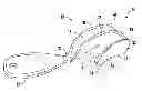 Fig. 01 - Reusable dental impression tray