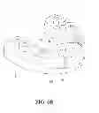 Fig. 07 - DENTAL POSITIONING STENT, AND MANUFACTURING METHOD, USING METHOD AND COMPONENTS FOR THE SAME