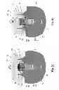 Fig. 04 - Dental retention systems