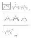 Fig. 02 - Process for producing a dental article, article obtainable by this process and uses thereof