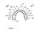 Fig. 02 - Dental appliance