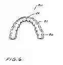 Fig. 07 - Dental appliance