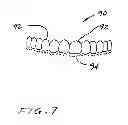 Fig. 08 - Dental appliance
