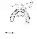 Fig. 09 - Dental appliance