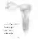 Fig. 02 - METHODS AND COMPOSITIONS FOR DETECTING ENDOMETRIAL OR OVARIAN CANCER