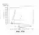 Fig. 12 - METHOD FOR EARLY DETERMINATION OF RECURRENCE AFTER THERAPY FOR PROSTATE CANCER