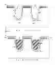 Fig. 09 - METHOD FOR MAKING GATE-OXIDE WITH STEP-GRADED THICKNESS IN TRENCHED DMOS DEVICE FOR REDUCED GATE-TO-DRAIN CAPACITANCE