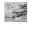Fig. 22 - PHOSPHO-ESTER DERIVATIVES AND USES THEREOF