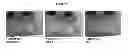 Fig. 06 - Methods for accelerated return of skin integrity and for the treatment of impetigo
