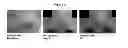 Fig. 07 - Methods for accelerated return of skin integrity and for the treatment of impetigo