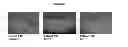 Fig. 09 - Methods for accelerated return of skin integrity and for the treatment of impetigo