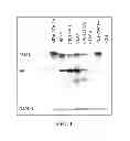 Fig. 02 - Elevated PSMA Identifies Lethal Prostate Cancers