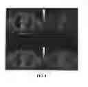 Fig. 09 - Elevated PSMA Identifies Lethal Prostate Cancers