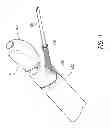 Fig. 02 - LUNG BIOPSY NEEDLE