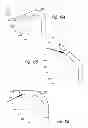 Fig. 19 - LUNG BIOPSY NEEDLE