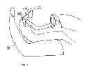 Fig. 11 - Adjustable Postural Support Device