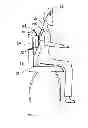 Fig. 12 - Adjustable Postural Support Device