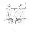 Fig. 13 - Adjustable Postural Support Device