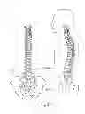 Fig. 02 - Apparatus, systems, and methods for achieving trans-iliac lumbar fusion