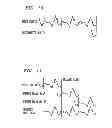 Fig. 09 - Method and apparatus for performing packet loss or frame erasure concealment