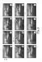 Fig. 04 - THREE DIMENSIONAL ULTRASONIC GUIDANCE OF SURGICAL INSTRUMENTS