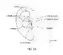 Fig. 02 - Earpiece passive noise attenuating