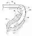 Fig. 01 - Medical instrument and method of performing a surgical procedure with the medical instrument